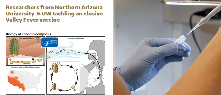 Researchers from Northern Arizona University & UW tackling an elusive Valley Fever vaccine
